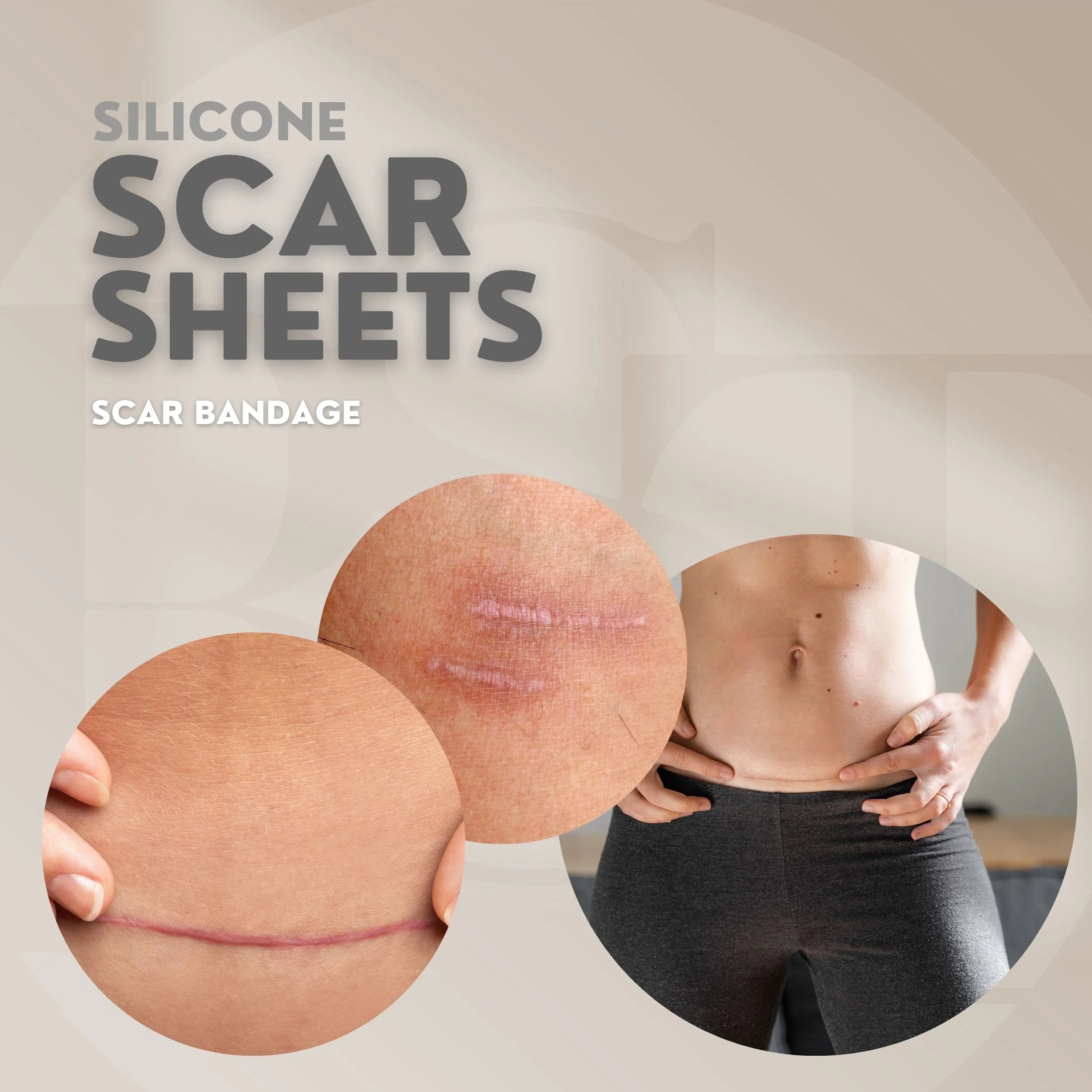 4 Pack Silicone Scar Sheets | Silicone Post-surgical Bandage